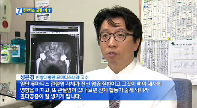 류마티스관절염, 골절 위험 4배 높아...예방법은?
